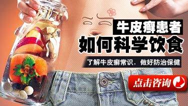 牛皮癣预防饮食与健康咨询