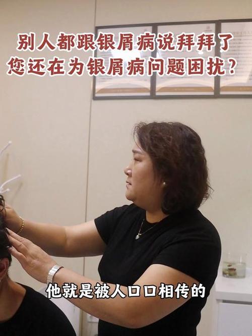 点击免费咨询银屑病,为您分析讲解自身银屑病目前的状况及后续如何