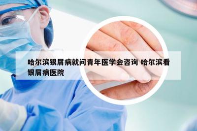 哈尔滨青年医学会银屑病防治咨询指南