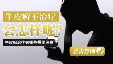 与牛皮癣成功“分手”，预防与咨询是关键