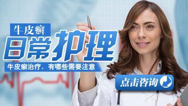牛皮癣患者适当午睡有好处？银屑病预防咨询