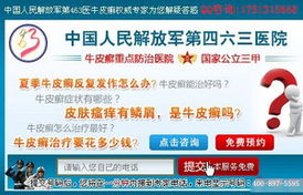 沈阳专业医院解析 如何科学治疗与预防银屑病（牛皮癣）